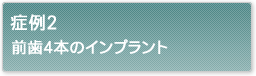 症例2前歯4本のインプラント